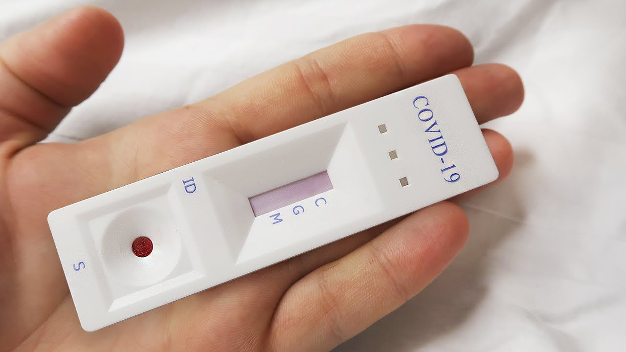 Что такое экспресс-тест и как он проходит