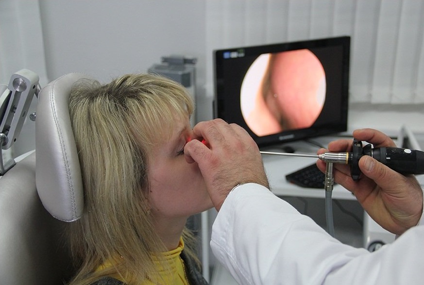 Степени аденоидов