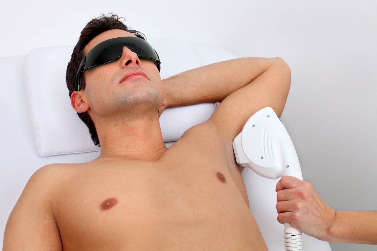 Мужчины и лазерная эпиляция