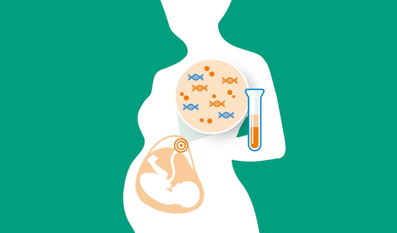 Неинвазивный пренатальный тест Veracity, почему сдают.