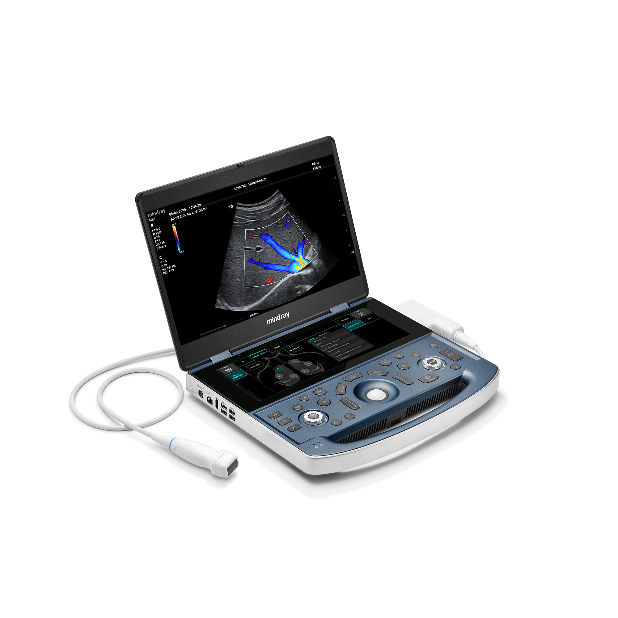 Хирургические столы и УЗИ-аппараты: как выбрать и на что обратить внимание