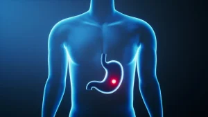 Синдром оперированного желудка: особенности, профилактика и восстановление