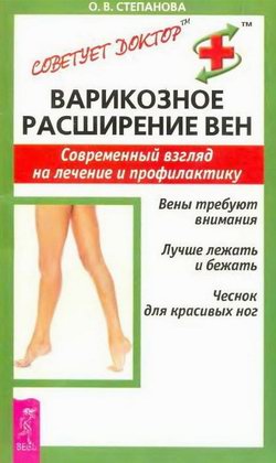 Варикозное расширение вен