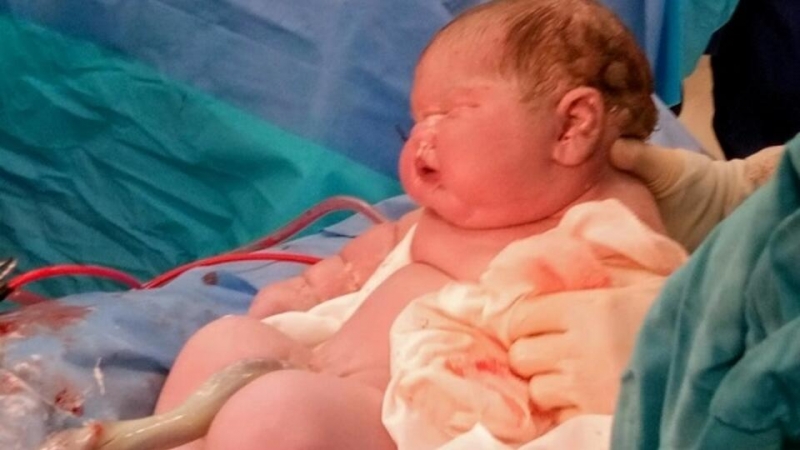 Британка родила младенца весом в 7 кг