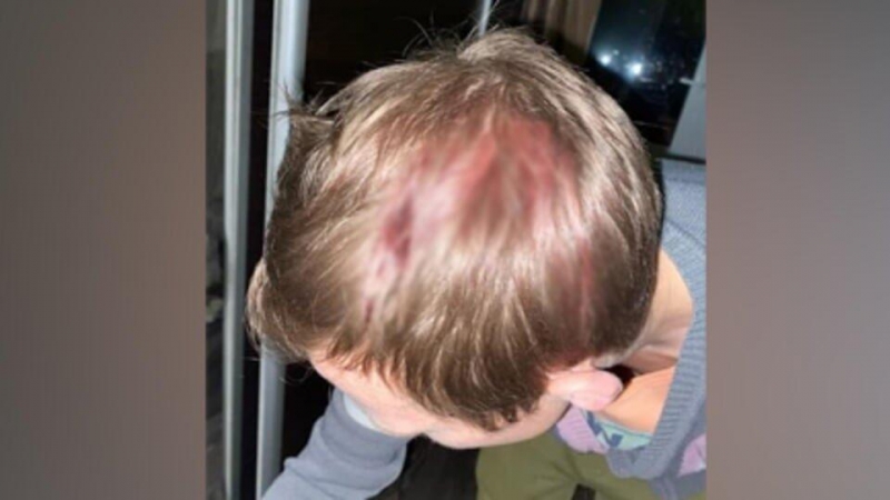 Дело заведено после нападения на мужчину за замечание в Балашихе