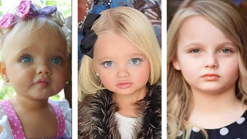 Не узнать: как стали выглядеть самые красивые дети мира спустя годы