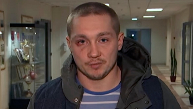 "Ребенка специально ударили": избитый отец раскрыл детали конфликта