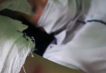 Жители Краснодара чудом отбили ребенка от стаи бродячих собак