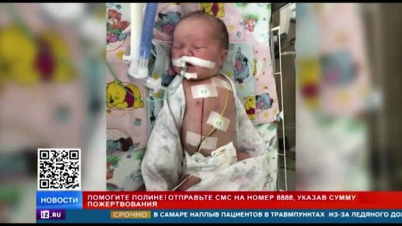 РЕН ТВ собирает средства на спасение маленькой Полины с пороком сердца