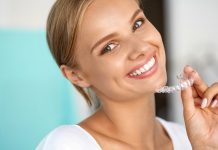 Что такое элайнеры и когда они помогут