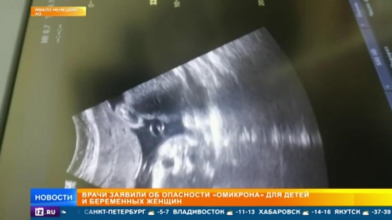 Беременные и дети оказались главной мишенью "омикрона"