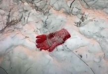 Глава Забайкалья призвал менять закон о животных после гибели девочки