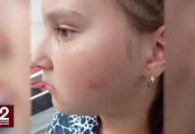 Мужчина потушил сигарету о щеку школьницы в Екатеринбурге