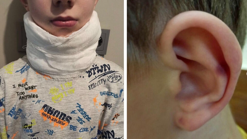 Неисправный лифт покалечил ребенка в московском ЖК "Селигер Сити"