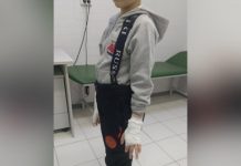 Первоклассник обморозил руки на уроке физкультуры в Екатеринбурге