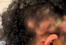 Подросток попыталась заживо сжечь одноклассника во время обеда в школе