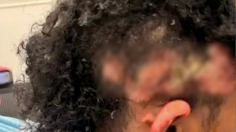 Подросток попыталась заживо сжечь одноклассника во время обеда в школе