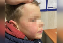 Мужчина избил 8-летнего мальчика за случайно попавший снежок