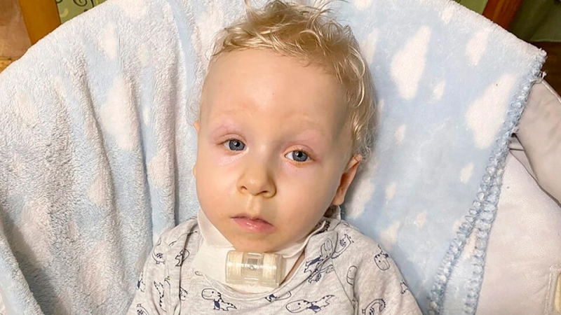 РЕН ТВ собирает деньги на спасение маленького Саши