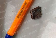 Российские хирурги достали осколок мины из головы ребенка из ЛНР