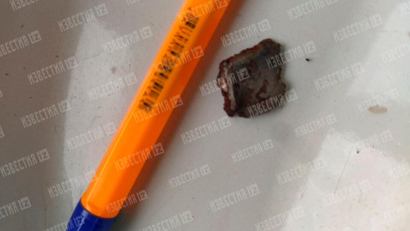 Российские хирурги достали осколок мины из головы ребенка из ЛНР