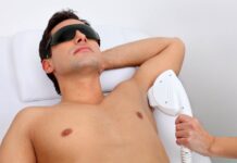 Мужчины и лазерная эпиляция