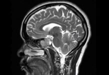 Что такое гипофиз, и почему так важно сделать его МРТ?