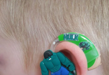 Слуховой аппарат для ребенка: Забота о слухе вашего малыша