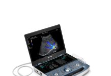 Хирургические столы и УЗИ-аппараты: как выбрать и на что обратить внимание