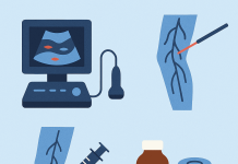 Новейшие методы диагностики и лечения венозных заболеваний: что важно знать студенту