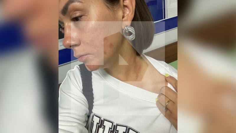 Душил и бил: многодетная мать раскрыла детали нападения экс-супруга