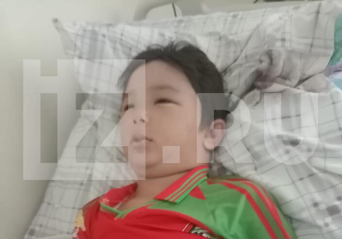 Маленькие братья из Башкирии рассказали, как пчелы ужалили их 465 раз