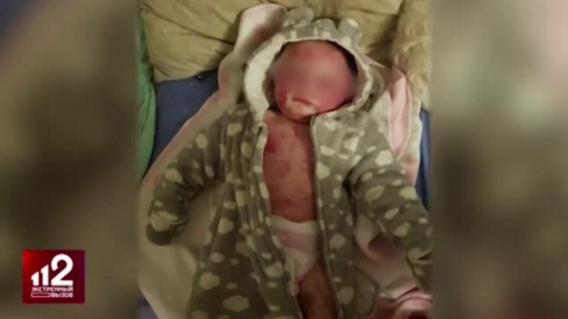 Мать годовалой девочки, избитой отчимом-садистом, ходит к нему в СИЗО