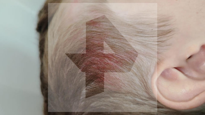 Медведь напал на ребенка в Петропавловске-Камчатском