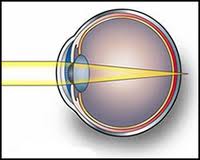 Дальнозоркость: лечение у детей Дальнозоркость: лечение у детей