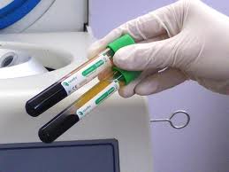 Инвентарь для плазмолифтинга Инвентарь для плазмолифтинга