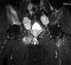 Общие сведения об МРТ кишечника Общие сведения об МРТ кишечника