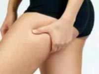 Избавляемся от растяжек Избавляемся от растяжек