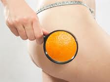 Борьба с целлюлитом Борьба с целлюлитом