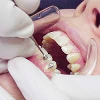 Ортодонтическое лечение