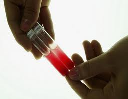 Лабораторная диагностика Лабораторная диагностика