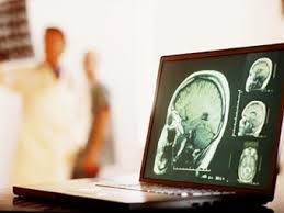 Можно ли вылечить рак головного мозга?