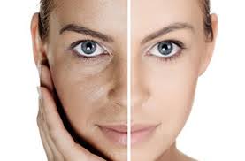 Плазмолифтинг Плазмолифтинг