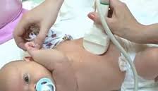 Ультразвуковое исследование для новорожденных Ультразвуковое исследование для новорожденных