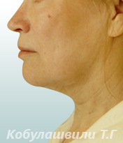 Меняем жизнь вместе с Клазко Меняем жизнь вместе с Клазко