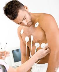 Мониторирование по Холтеру