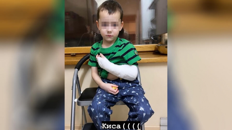 Сын Кержакова сломал руку в детском саду